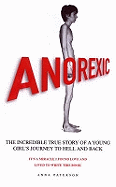 Anorexic