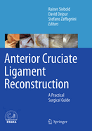 Anterior Cruciate Ligament Reconstruction: A Practical Surgical Guide