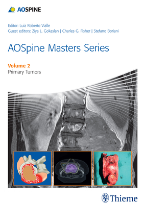 Aospine Masters Series Volume 2: Primary Spinal Tumors - Vialle, Luiz Roberto Gomes (Editor), and Gokaslan, Ziya L (Guest editor), and Fisher, Charles G (Guest editor)