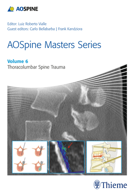 AOSpine Masters Series, Volume 6: Thoracolumbar Spine Trauma - Vialle, Luiz Roberto Gomes (Series edited by), and Bellabarba, Carlo (Guest editor), and Kandziora, Frank (Guest editor)