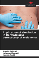 Application of simulation in Dermatology: dermoscopy of melanoma