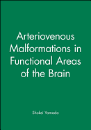 Arteriovenous Malformations in Functional Areas of the Brain