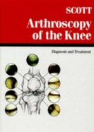 Arthroscopy of the Knee: Diagnosis & Treatment
