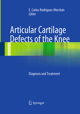 Articular Cartilage Defects of the Knee: Diagnosis and Treatment - Rodrguez-Merchn, E Carlos (Editor)
