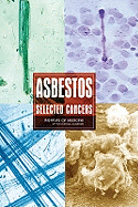 Asbestos: Selected Cancers