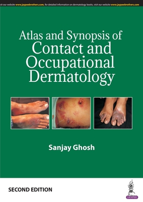 Atlas and Synopsis of Contact and Occupational Dermatology - Ghosh, Sanjay