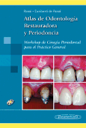 Atlas de Odontologia Restauradora y Periodoncia: Workshop de Cirugia Periodontal Para el Practico General