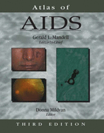 Atlas of AIDS