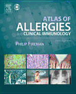 Atlas of Allergies and Clinical Immunology: Text with CD-ROM