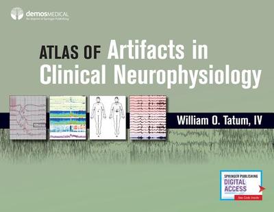 Atlas of Artifacts in Clinical Neurophysiology - Tatum, William