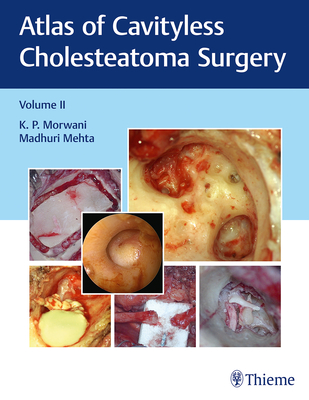 Atlas of Cavityless Cholesteatoma Surgery, Vol 2 - Morwani, K, and Mehta, Madhuri