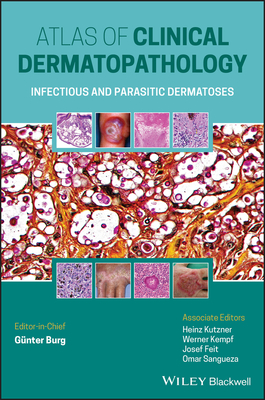 Atlas of Clinical Dermatopathology: Infectious and Parasitic Dermatoses - Burg, Gnter, and Kutzner, Heinz, and Kempf, Werner