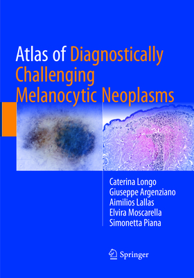 Atlas of Diagnostically Challenging Melanocytic Neoplasms - Longo, Caterina, and Argenziano, Giuseppe, MD, and Lallas, Aimilios