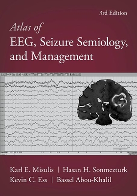 Atlas of Eeg, Seizure Semiology, and Management - Abou-Khalil, Bassel, and Misulis, Karl Edward, and Sonmezturk, Hasan