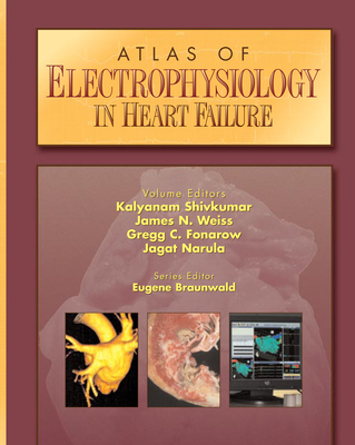 Atlas of Electrophysiology in Heart Failure - Shivkumar, Kalyanam (Editor), and Weiss, James N (Editor), and Fonarow, Gregg C (Editor)