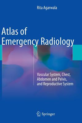 Atlas of Emergency Radiology: Vascular System, Chest, Abdomen and Pelvis, and Reproductive System - Agarwala, Rita