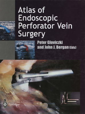 Atlas of Endoscopic Perforator Vein Surgery - Gloviczki, Peter (Editor), and Bergan, John (Editor)