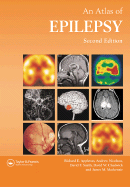 Atlas of Epilepsy