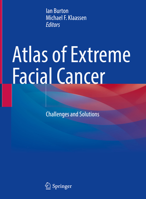 Atlas of Extreme Facial  Cancer: Challenges and Solutions - Burton, Ian (Editor), and Klaassen, Michael F. (Editor)
