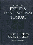 Atlas of Eyelid and Conjunctival