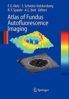 Atlas of Fundus Autofluorescence Imaging - Holz, Frank G. (Editor), and Schmitz-Valckenberg, S. (Editor), and Spaide, Richard F. (Editor)