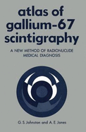 Atlas of Gallium - Sixty-Seven Scintigraphy: A New Method of Radioisotope Diagnosis - Johnston, Gerald S