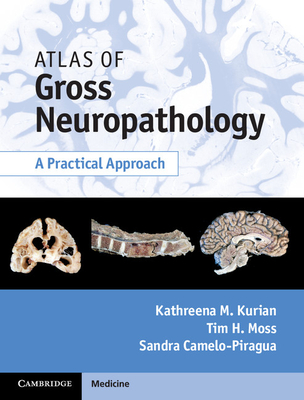 Atlas of Gross Neuropathology Book and Online Bundle: A Practical Approach - Kurian, Kathreena M., and Moss, Tim H., and Camelo-Piragua, Sandra