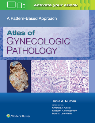 Atlas of Gynecologic Pathology: A Pattern-Based Approach: Print + eBook with Multimedia - Numan, Tricia A., MD