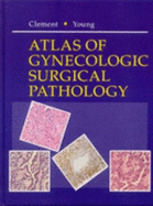 Atlas of Gynecologic Surgical Pathology: A Volume in the Atlases in Diagnostic Surgical Pathology Series - Clement, Philip B, MD, and Young, Robert H, MD
