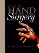 Atlas of Hand Surgery - Conolly, Bruce W