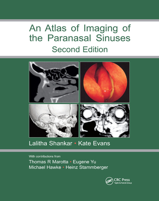 Atlas of Imaging of the Paranasal Sinuses, Second Edition - Shankar, Lalitha (Editor), and Evans, Kathryn (Editor)