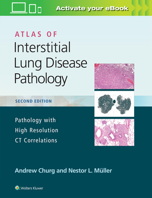 Atlas of Interstitial Lung Disease Pathology - Churg, Andrew, MD, and Muller, Nestor L