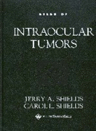 Atlas of Intraocular Tumors