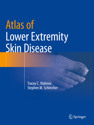 Atlas of Lower Extremity Skin Disease - Vlahovic, Tracey C., and Schleicher, Stephen M.
