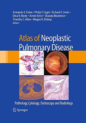 Atlas of Neoplastic Pulmonary Disease: Pathology, Cytology, Endoscopy and Radiology - Fraire, Armando E (Editor), and Cagle, Philip T, MD (Editor), and Irwin, Richard S, MD (Editor)