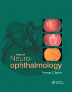 Atlas of Neuro-Ophthalmology