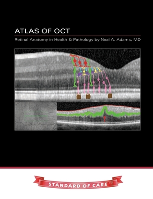 Atlas of OCT: Retinal Anatomy in Health & Pathology - Adams, Neal