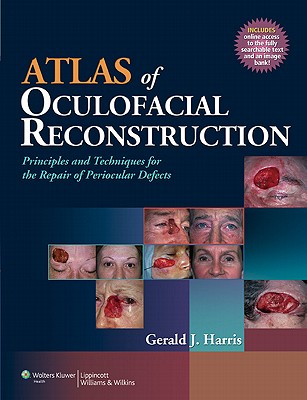 Atlas of Oculofacial Reconstruction: Principles and Techniques for the Repair of Periocular Defects - Harris, Gerald J, MD, Facs