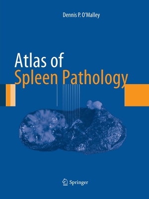 Atlas of Spleen Pathology - O'Malley, Dennis P
