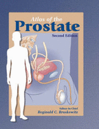 Atlas of the Prostate