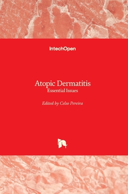 Atopic Dermatitis: Essential Issues - Pereira, Celso (Editor)