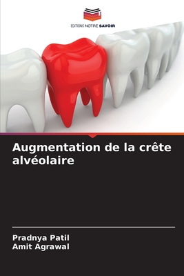 Augmentation de la crete alveolaire - Patil, Pradnya, and Agrawal, Amit