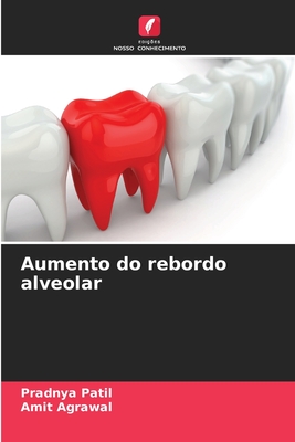 Aumento do rebordo alveolar - Patil, Pradnya, and Agrawal, Amit