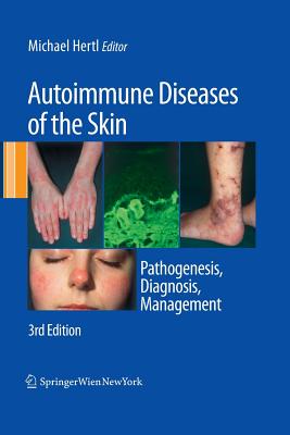Autoimmune Diseases of the Skin: Pathogenesis, Diagnosis, Management - Hertl, Michael (Editor)