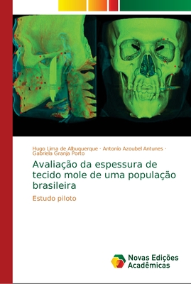 Avalia??o da espessura de tecido mole de uma popula??o brasileira - Lima de Albuquerque, Hugo, and Azoubel Antunes, Antonio, and Granja Porto, Gabriela