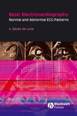 Basic Electrocardiography: Normal and Abnormal ECG Patterns - Bays de Luna, Antoni