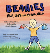 Beanies, Ball Caps, and Being Bald: Different Isn't Bad, Different Is Just Different