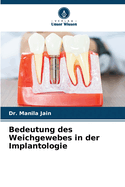 Bedeutung des Weichgewebes in der Implantologie