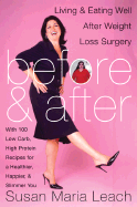 Before & After: Living & Eating Well After Weight Loss Surgery