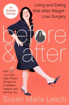 Before & After, Second Revised Edition: Living and Eating Well After Weight-Loss Surgery - Leach, Susan Maria